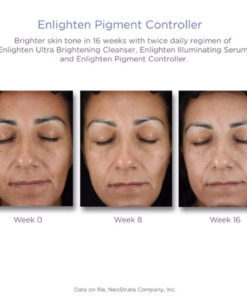 Enlighten Despigmentante Facial