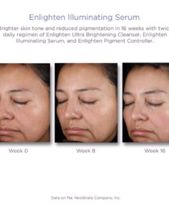 Enlighten Suero Facial