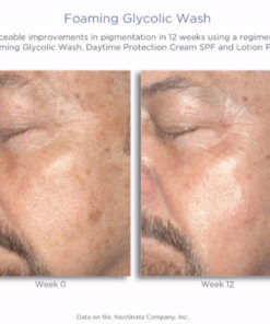 Foaming Glycolic Wash