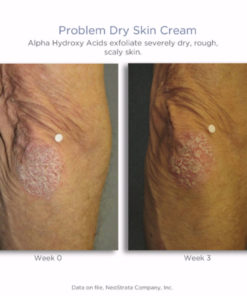 Problem Dry Skin Cream