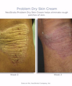 Problem Dry Skin Cream