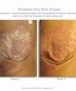 Problem Dry Skin Cream