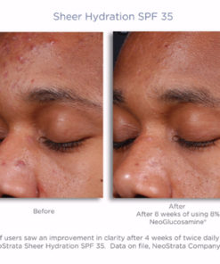 Alternative view of NeoStrata® Sheer Hydration SPF 40