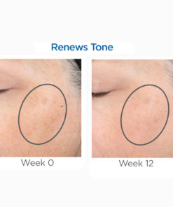 Alternative view of Skin Active Tri-Therapy Lifting Serum (S.A. Suero de Levantamiento Tri-Terapia)