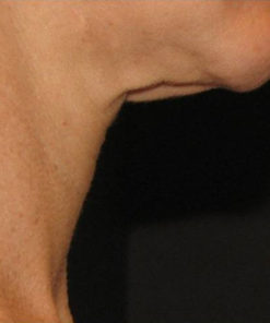 Triple Firming Neck Cream - Semana 0