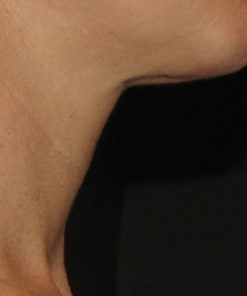 Triple Firming Neck Cream - Semana 16