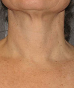 Triple Firming Neck Cream - Semana 16